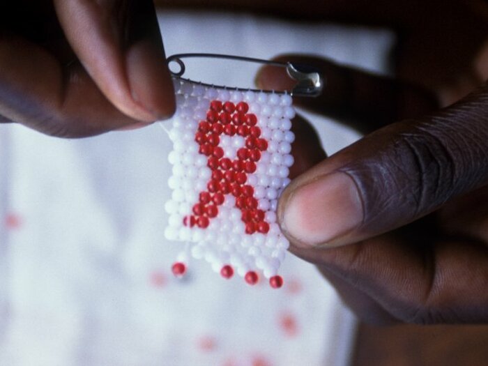 Health and wellness support to people living with HIV/AIDS in DRC.